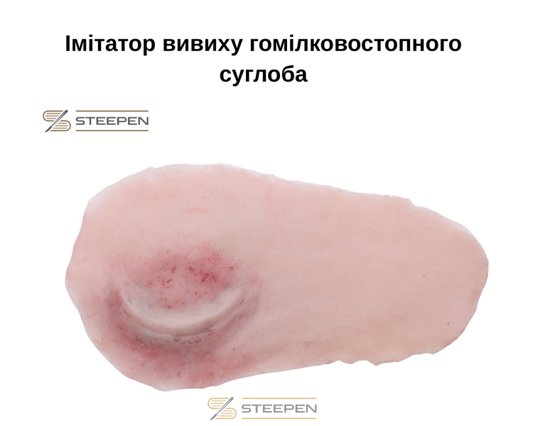 Імітатор вивиху гомілковостопного суглоба TS43-01 фото