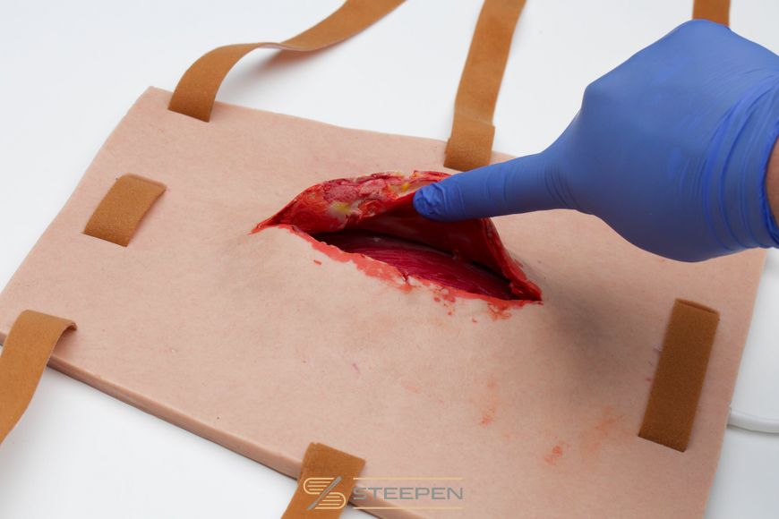 Extensive Superficial Wound Tamponade Trainer